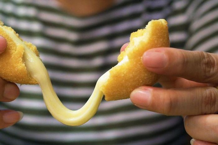 Watch This Back Cyst Release Cheese-Like Pus