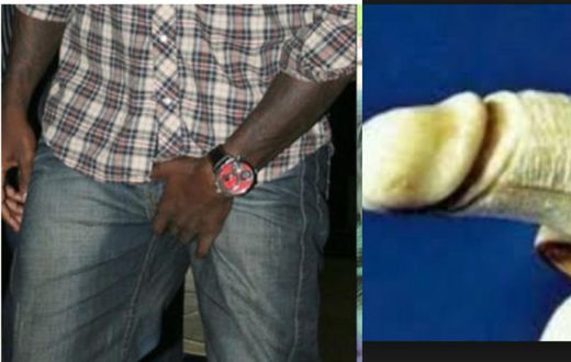 Man and wife cry for help as penis enlargement charm bloated his manhood beyond comfort
