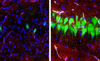 Study Opens Up a Gap Between Life and Death