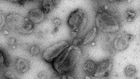 Cancer's Trick for Dodging the Immune System