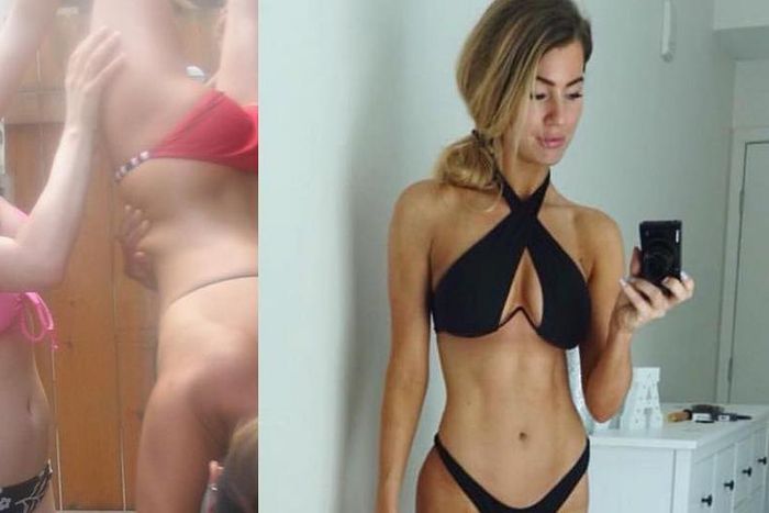Anna Victoria Posted An Amazing Before-After Pic