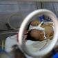 The twin boys shared a kidney and a pair of legs but had separate hearts and lungs