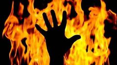 Burnt to death