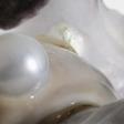 Dr. Pimple Popper Popped A 'Cute' Pilar Cyst