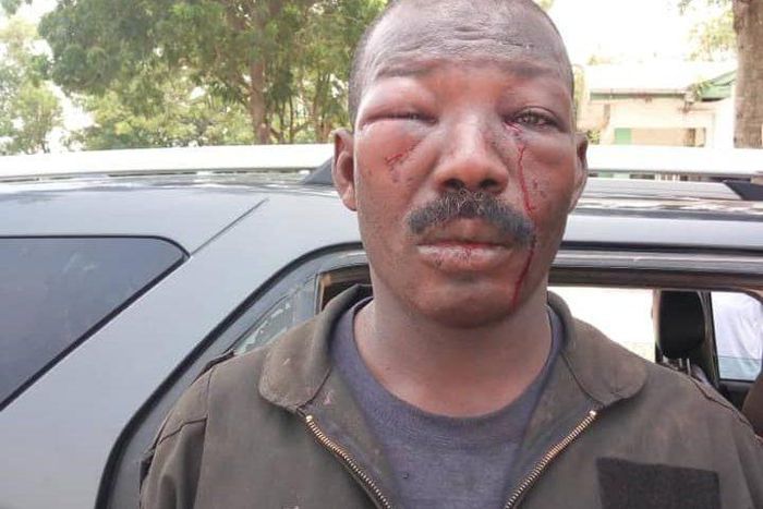 Police officer mercilessly beaten