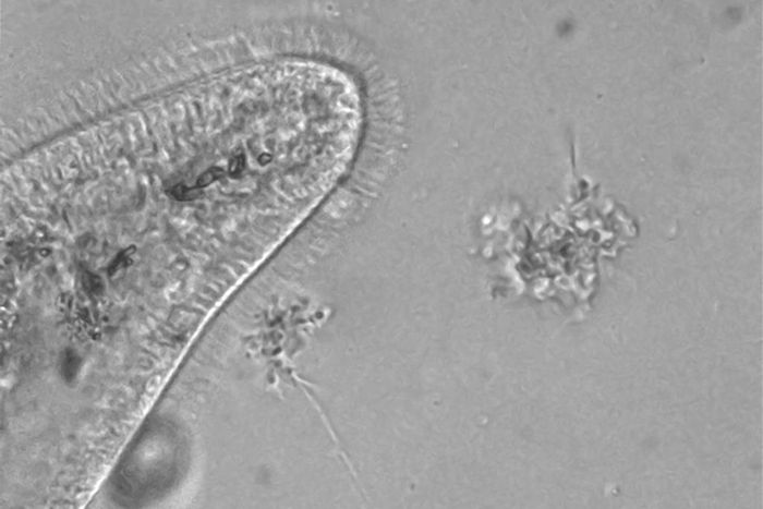 The Microbots Are on Their Way