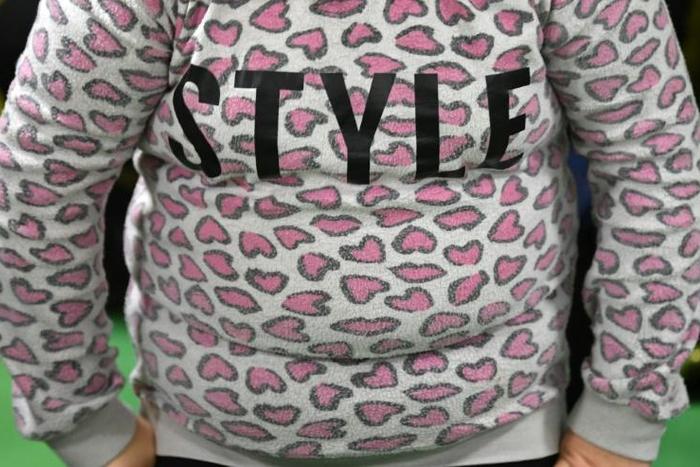Obesity has more than doubled in the United States over the last four decades