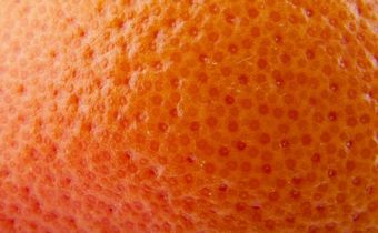 The Best Cellulite Treatments