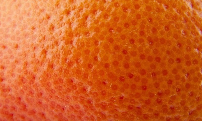 The Best Cellulite Treatments