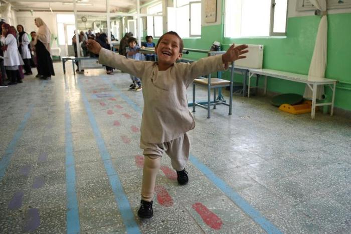 Ahmad Sayed Rahman received his first prosthetic at age one, and soon learned to dance, his delight clear for all to see