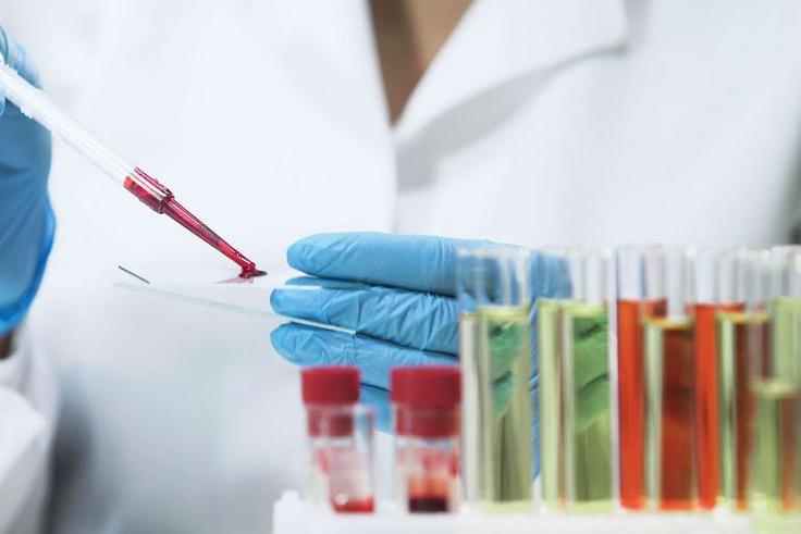 Second HIV Patient Has Been "Cured" of the Diseae
