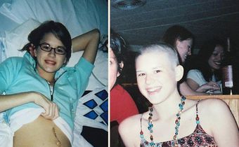 I Was Diagnosed With Ovarian Cancer When I Was 17