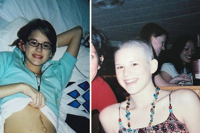 I Was Diagnosed With Ovarian Cancer When I Was 17