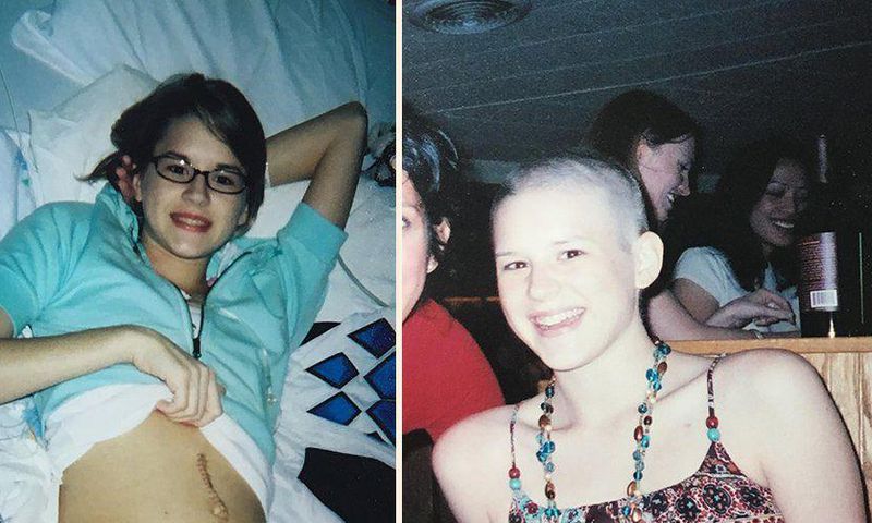 I Was Diagnosed With Ovarian Cancer When I Was 17