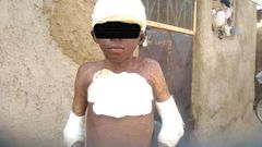Man burns 11-year-old boy with petrol for peeping at woman in bathroom