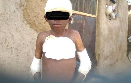 Man burns 11-year-old boy with petrol for peeping at woman in bathroom