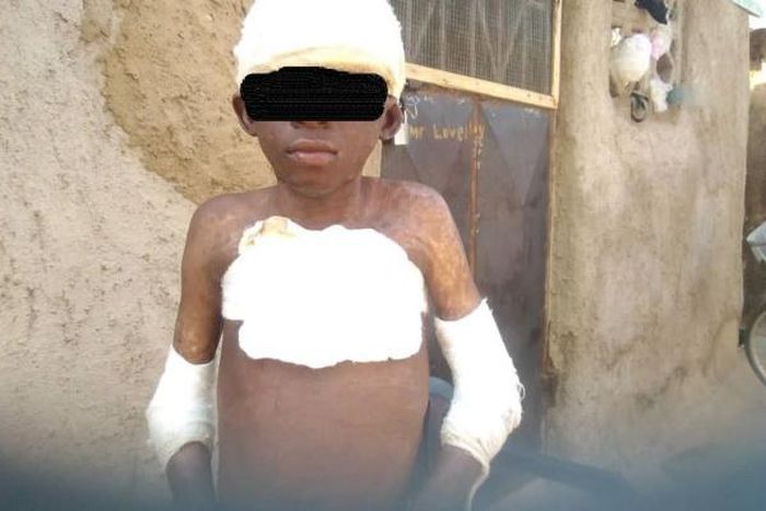 Man burns 11-year-old boy with petrol for peeping at woman in bathroom