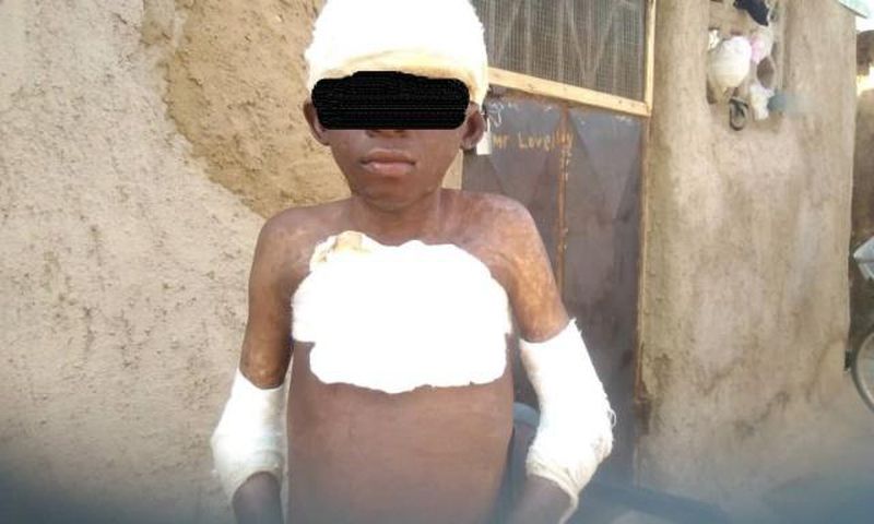 Man burns 11-year-old boy with petrol for peeping at woman in bathroom