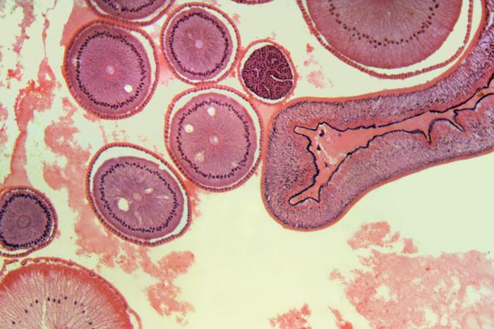 What You Need To Know About The Gaps Diet