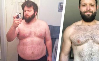 Man Beats Sugar Cravings and Loses 142 Pounds