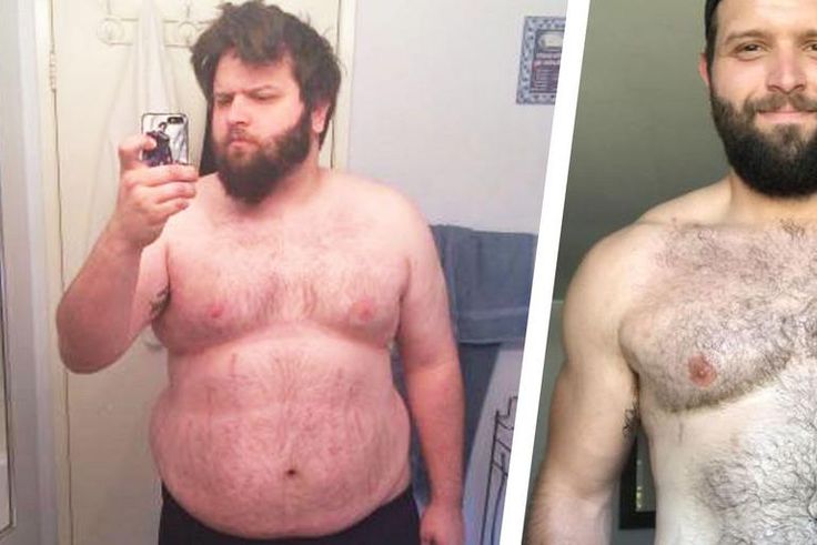Man Beats Sugar Cravings and Loses 142 Pounds