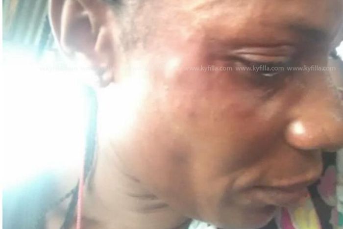 ref Theresa Bremansu