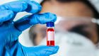 New Blood Tests Could Replace Biopsies, MRIs