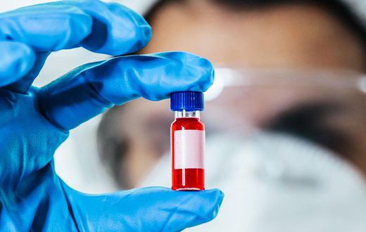 New Blood Tests Could Replace Biopsies, MRIs