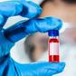 New Blood Tests Could Replace Biopsies, MRIs