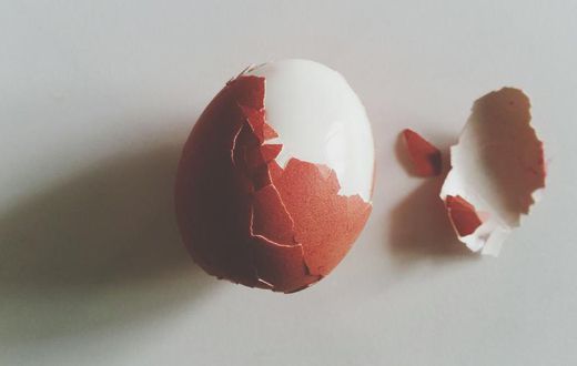 Dr. Pimple Popper Removes Egg-Shaped Cyst