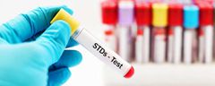 Everyone needs to test for STIs