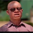 Akuamufie chiefs and elders drive away persons with albinism