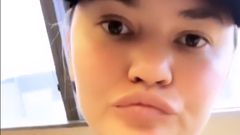 Chrissy Teigen's Tooth Fell Out