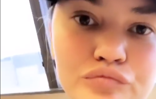 Chrissy Teigen's Tooth Fell Out