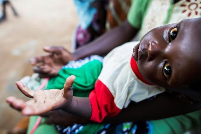 Hunger has stalked South Sudan for years, driven by the country's disastrous civil war