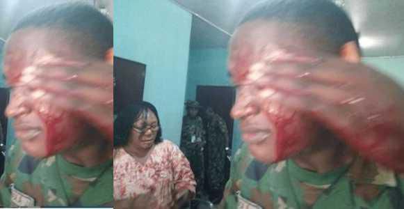‘Fearless’ mother inflicts machete wounds on soldier for flogging her daughter