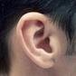 Dr. Pimple Popper Pops Cyst Behind Someone's Ear
