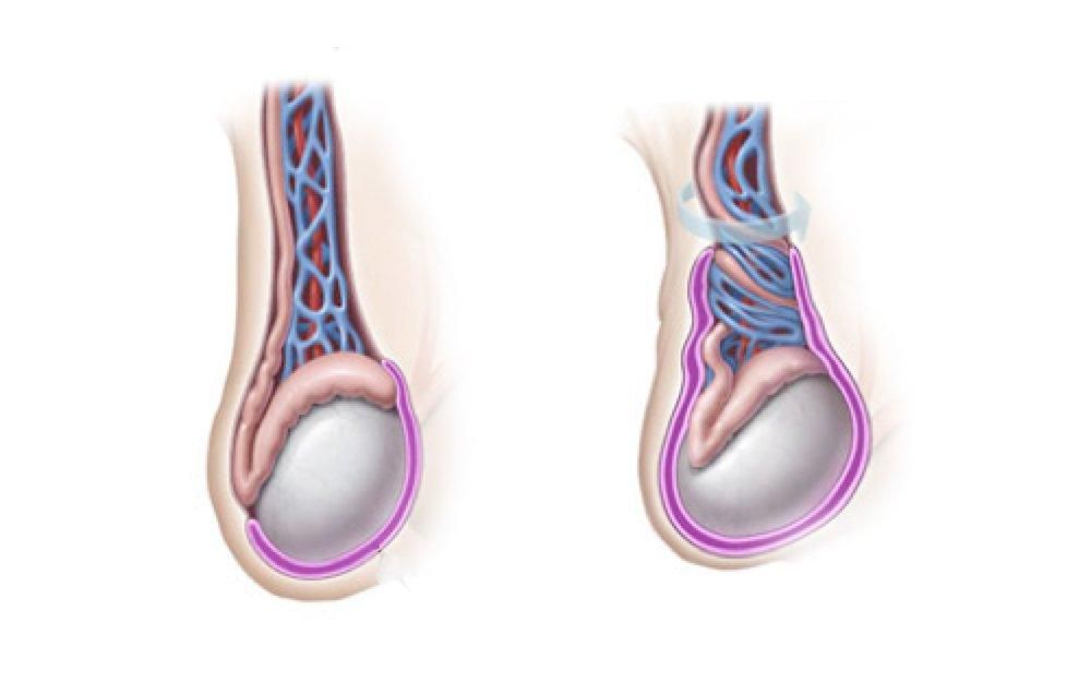 You could lose a testicle while you're asleep.