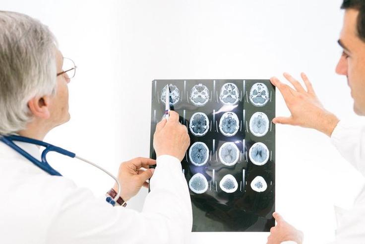 Closing In on Alzheimer's Disease