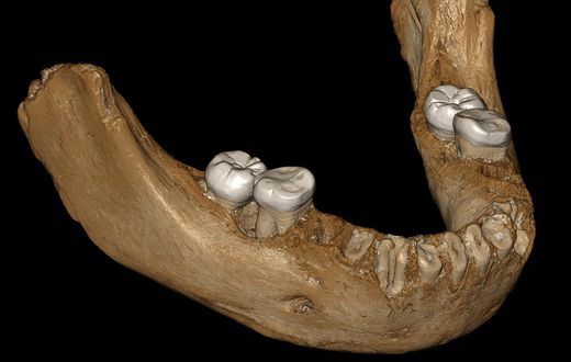 Denisovan Jawbone Discovered in a Cave in Tibet