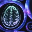 Men's Brains are Older than Women's