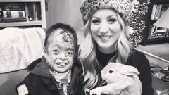 Kaley Cuoco Honors Friend With Skin Disease