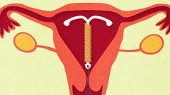 8 Facts About Sex When You Have An IUD