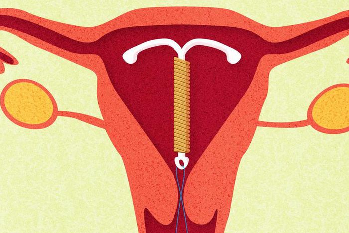 8 Facts About Sex When You Have An IUD