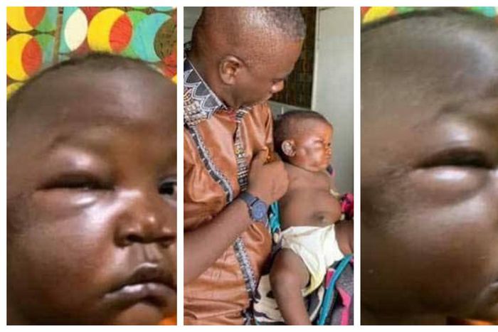 Heartless father brutalises 1-year-old daughter out of anger
