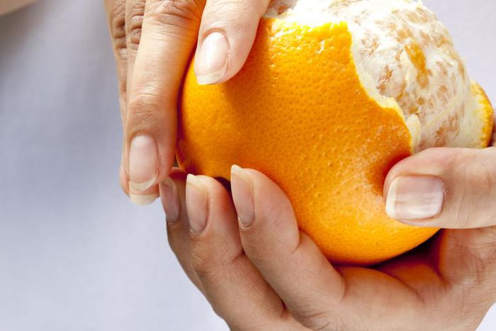 Dr. Pimple Popper Just Popped An 'Orange' Lipoma