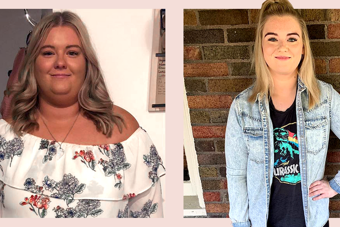 'I Lost 110 Pounds After Weight-Loss Surgery'