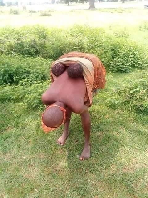 Mentally challenged woman gives birth to twins in the bush (photos)