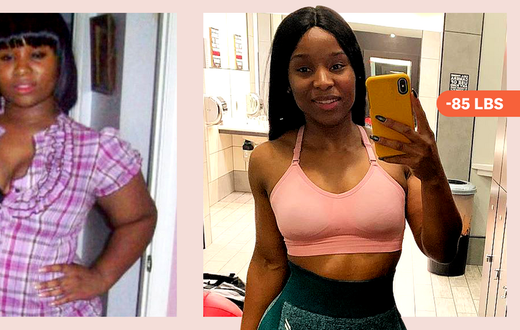 'I Lost 85 Lbs. When I Got My PCOS Under Control'