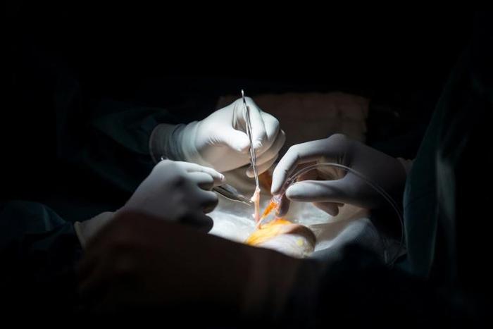 The analysis, published in JAMA Internal Medicine, found that French transplant centers would have transplanted more than 60 percent - about 17,500 kidneys - of the nearly 28,000 deceased-donor kidneys discarded in the United States between 2004 and 20...